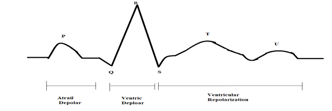 Standard 12- lead ECG Signal